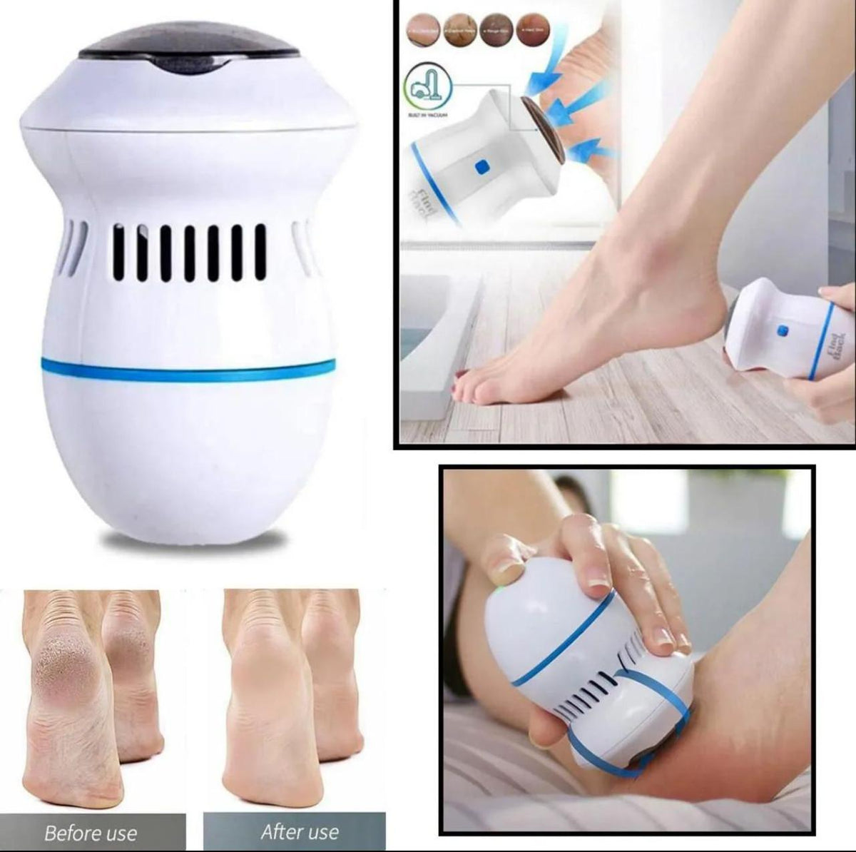 Electric Foot Callus Remover ā Pedicure Foot Care Tool for Dead Skin & Rough Heels